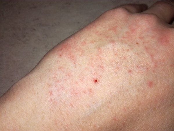 IMG_20171210_153019.jpg (3.15 MiB) Zobrazeno 1006 x IMG_20171210_153019.jpg